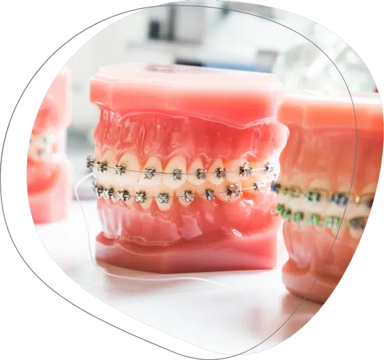 Ortodoncia con brackets en la clinica dental Agudo Rosa